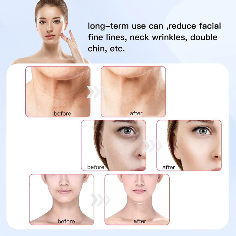 Musclarity™ Face Neck Lifting Machine Anti Aging Facial Massager